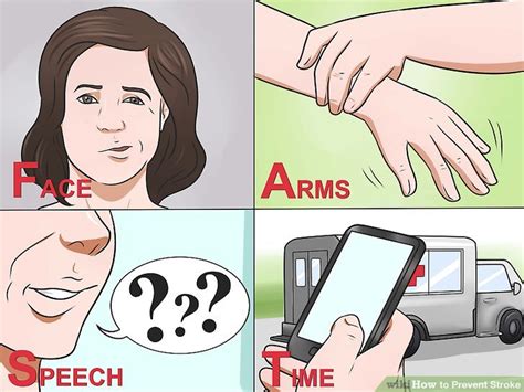 How To Prevent Stroke 8 Steps With Pictures Wikihow Health