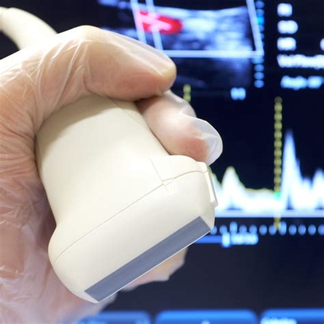 Vascular Sonography Essentials Board Review Sonopoint