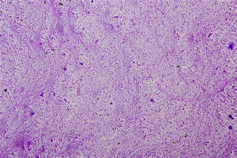 400 Negative Stain Photos Stock Photos Pictures And Royalty Free Images