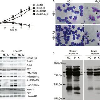 Hnrnp K Knockdown Leads To Cell Proliferation Reduction That Is