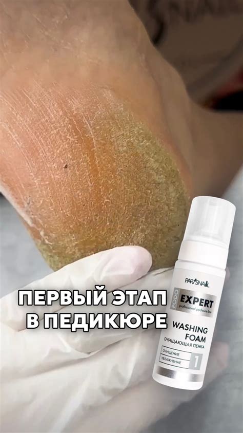 Pedicure beauty and podology problem | СКРУЧЕННЫЕ НОГТИ. Как помочь ...