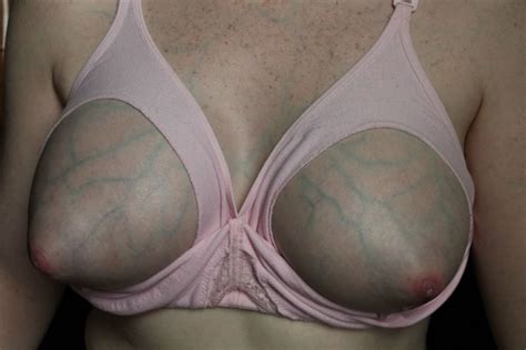 Nursing Bra Porn Pictures XXX Photos Sex Images 3973862 PICTOA