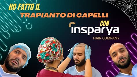 Ho Fatto Il Trapianto Di Capelli La Mia Esperienza Con Insparya Youtube