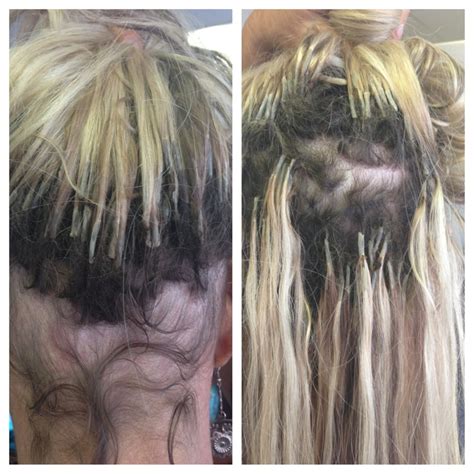 17 Best Images About Bad Extensions On Pinterest Greasy Hair Lady