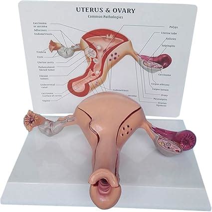 Enseñanza Modelo de útero Humano anatómico ovarios y patologías del