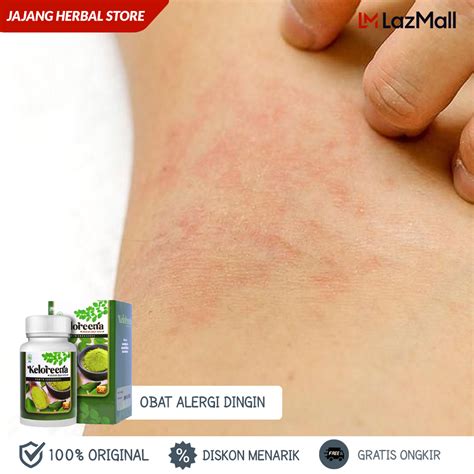 Obat Alergi Dingin Bentol Id