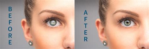 Grin Eye Care Olathe Leawood Ks And Grandview Mo Optometrist