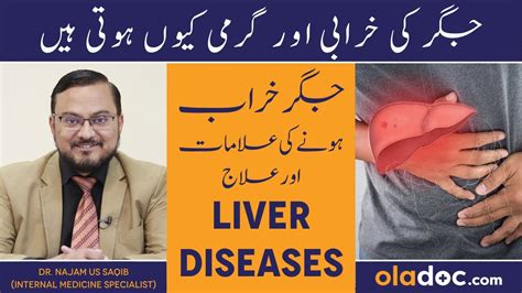 Jigar Ke Amraz Ka Ilaj Liver Disease Treatment In Urdu Fatty Liver