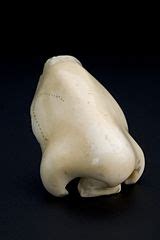 categorynose prostheses wikimedia commons