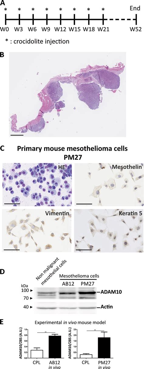 Development Of A Primary Mesothelioma Pm Cell Line And Expression