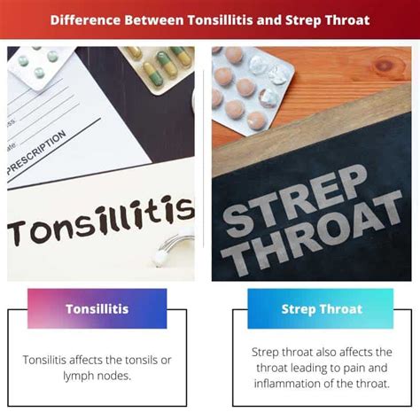 Tonsillitis vs Strep Throat: Difference and Comparison