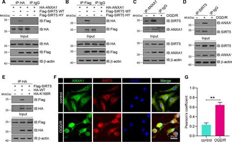 The Interaction Of Sirt And Anxa Increases After Ogd R A B Hek T