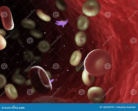 Diseased Blood Cells Stock Illustration Illustration Of Artery 146232978