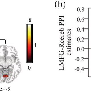 Sex Differences In Functional Connectivity Sagittal Coronal And