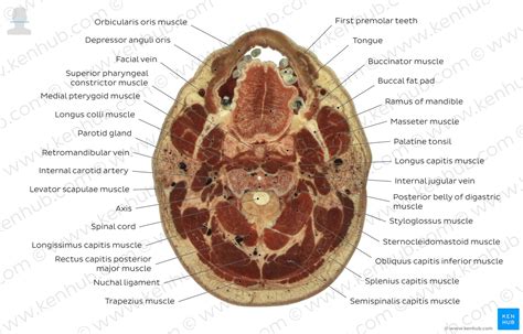 Cross sectional anatomy | Kenhub