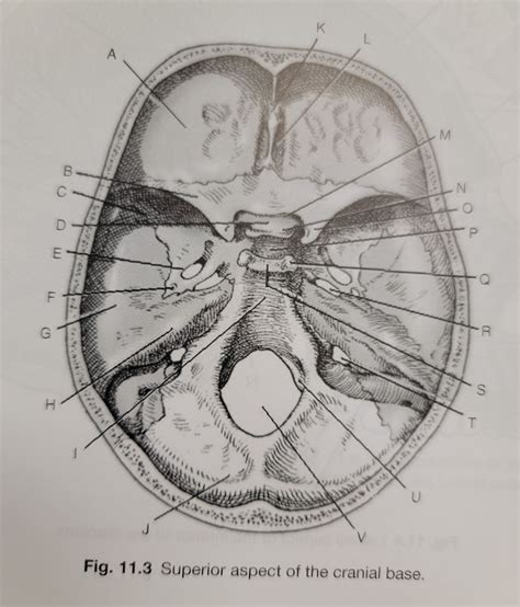 Superior Aspect Of The Cranial Base Diagram Quizlet