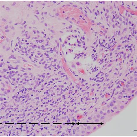 Representative Histopathology Results A Hematoxylin And Eosin Hande