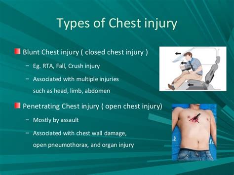 Chest Trauma