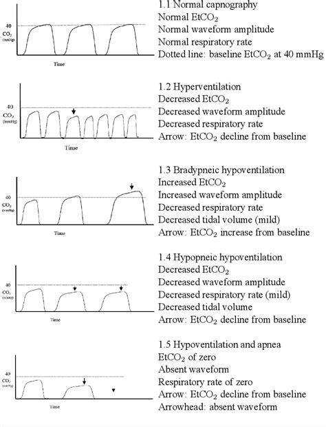 Pdf Applications Of Capnography In Airway Management Outside The