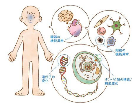 31 ヒトの遺伝性疾患｜日本医学会連合 ゲノム編集解説ウェブサイト