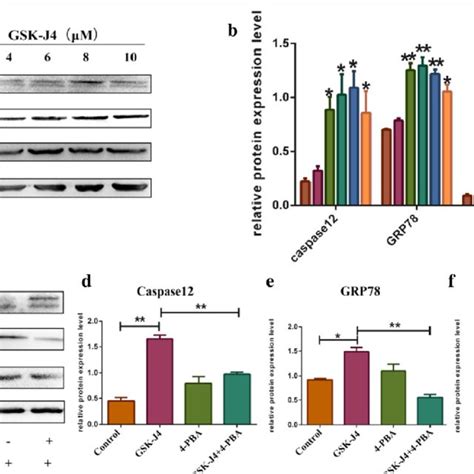 ER Stress Is Stimulated By GSK J4 In KG 1a Cells A The Expression