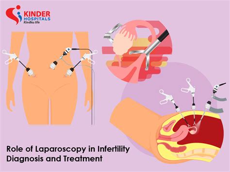 Kinder Hospital Fertility Hospital In Whitefield