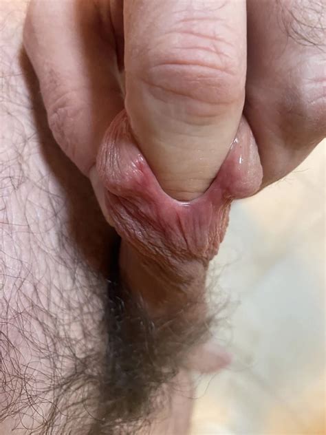 Stretching My Peehole With My Index Finger 2 Nude Pics XHamster