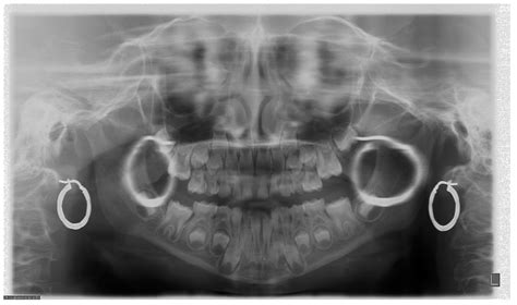 Basic Knowledge And New Advances In Panoramic Radiography Imaging