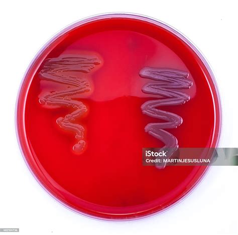Bacterial Beta Hemolysis On Blood Sheep Agar Stock Photo Download