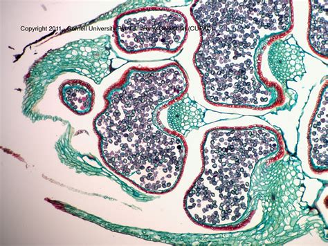 CUPAC ANATOMY SLIDE IMAGES