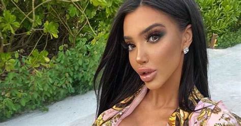 X Factor Star Plans Next Barbie Vagina Surgery Despite Horror First Operation Showcelnews