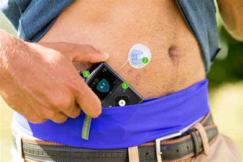 How To Use An Automatic Glucose Pump