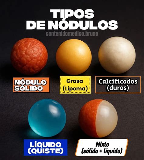 O Que Significa Nódulo