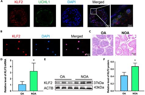 KLF2 Controls Proliferation And Apoptosis Of Human Spermatogonial Stem