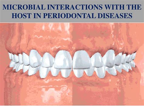 Ppt Microbial Interactions With The Host In Periodontal Diseases Powerpoint Presentation Id