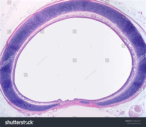 232 Cartilage rings Images, Stock Photos & Vectors | Shutterstock