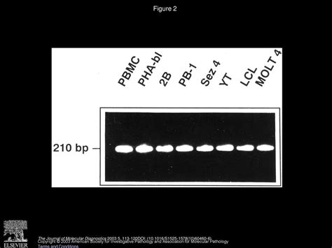 Detection Of Protein Tyrosine Kinase PTK Gene Expression Pattern In