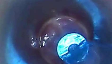 Test Tube Cock Endoscope Pov Urethral Insertion Ball Rod Tnaflix Porn Videos