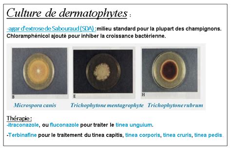 Sabouraud Dextrose Agar (SDA) Composition, Principle, Uses,, 46% OFF