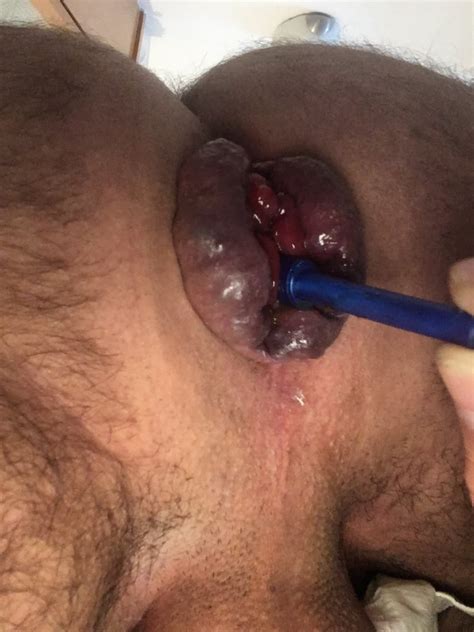 Tampon Porno Bilder Sex Fotos XXX Bilder 3843646 PICTOA