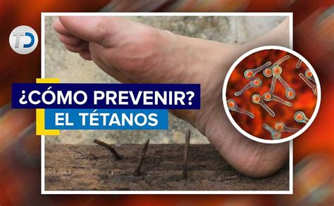 Tétanos qué es cómo prevenir síntomas Telediario México