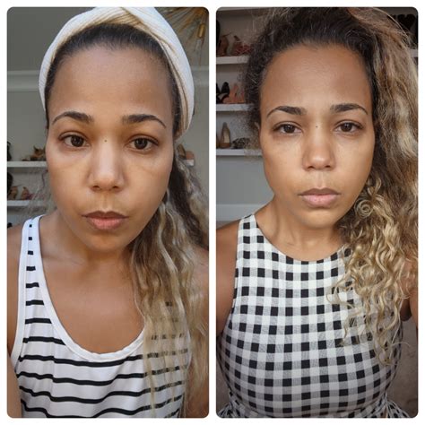 The Incredible Transformation: From Botox to HerbalFaceFood Serum ...
