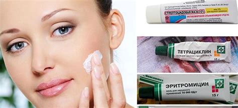 Цинковая Мазь От Каких Прыщей – Telegraph