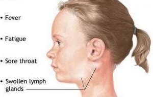 Glandular Fever symptoms in adults, children | HealthFoxx