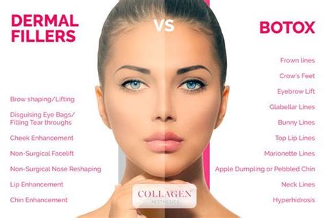 Botox Vs Dermal Fillers What You Need To Know Contorno De Labios