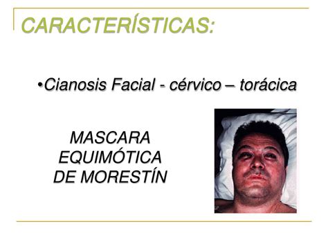 Mascara Equimotica De Morestin - PPT - ASFIXIA PowerPoint Presentation, free download - ID:1061653