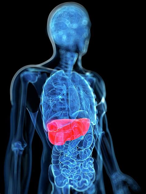 Liver Cancer Photograph By Scieproscience Photo Library Fine Art America