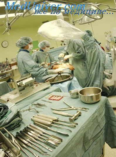 Кишечный свищ. Классификация кишечных свищей.