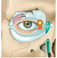 Lacrimal caruncle - e-Anatomy - IMAIOS