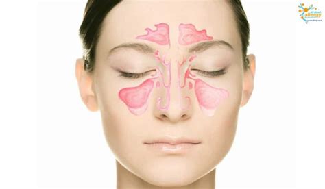 Заложен нос, что делать если хронический ринит